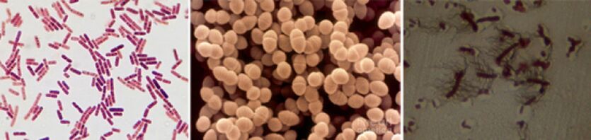 E. coli, enterococos fecais e proteus são os principais agentes causadores da prostatite bacteriana crônica