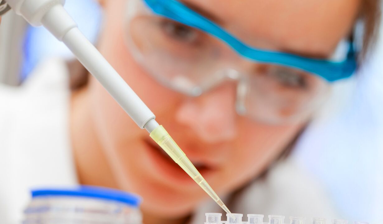 Análise laboratorial da urina - um método para diagnosticar a prostatite